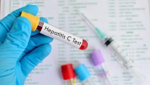 Hepatitele B și C, sub lupă: statul oferă testare gratuită pentru depistarea precoce